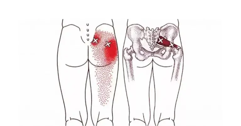 Top 10 Exercises For Piriformis Syndrome To Help You Get Rid Of Your Pain – Piriformis Stretches To Remove Hip And Lower Back Pain
